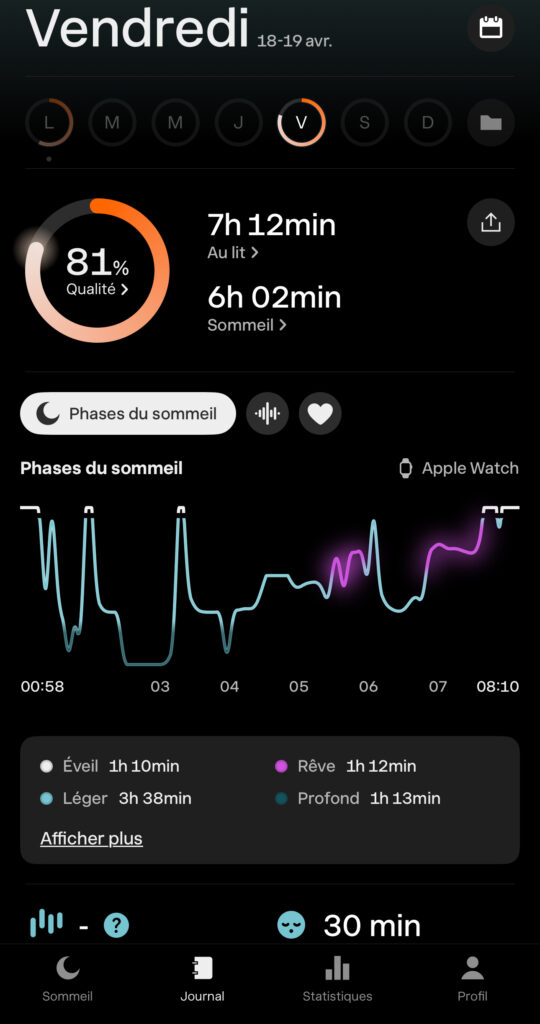 sleep cycle 2 sleep cycle 2